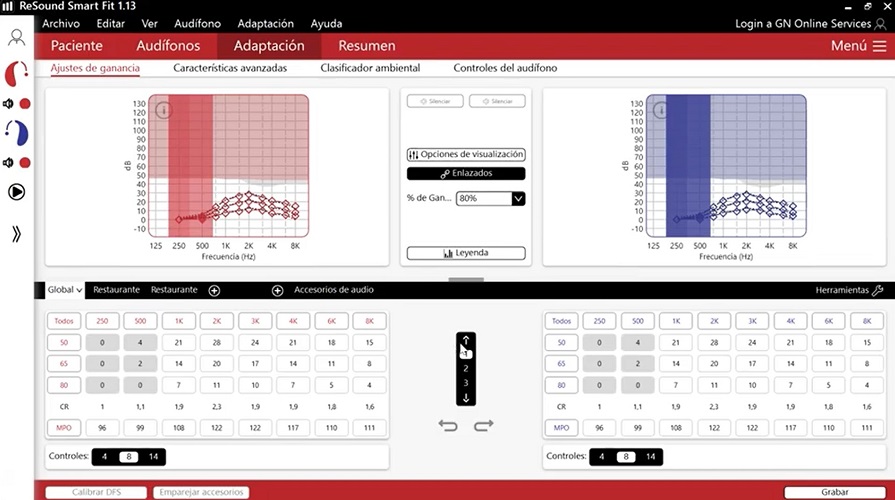 importancia del realce de graves en la transmisión